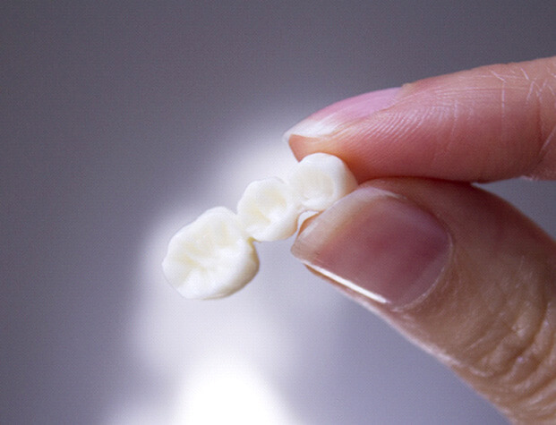 someone holding a dental bridge