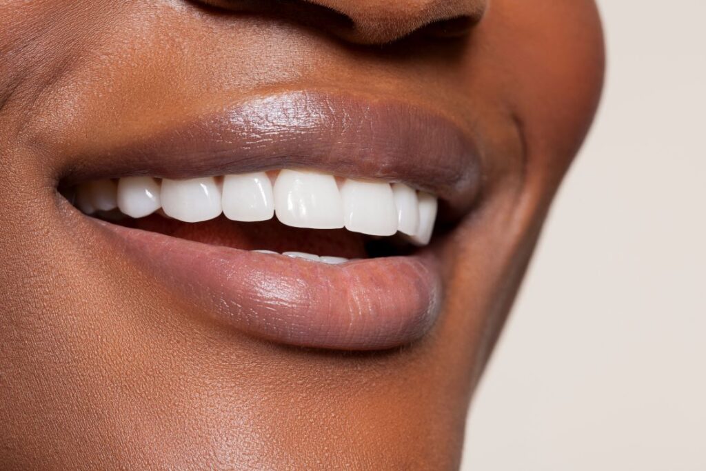 A closeup of a woman’s smile